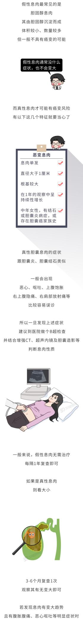 中国胆囊癌高发，罪魁祸首被揪出！提醒：有这 2 种饮食习惯，尽早改