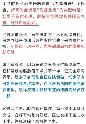 男子自以为魅力十足？老婆嫌弃多年！瑞金医院医生从他的身上割下10斤重....